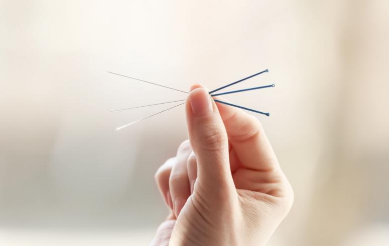 How To Book an Acupuncture Service for Your Pet and Baby How To Book an Acupuncture Service for Your Pet and Baby