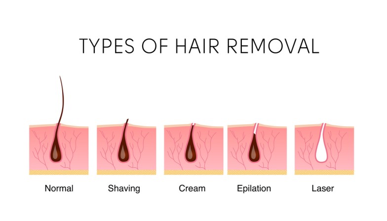 Hair Removal
