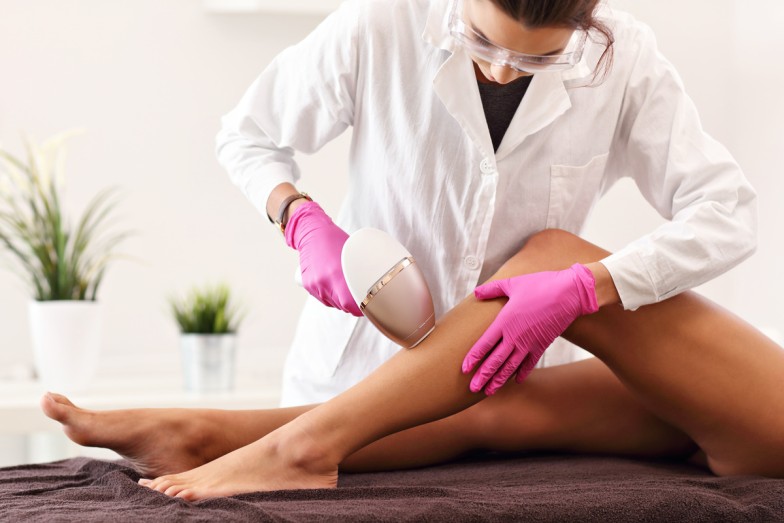 YAG Laser Hair Removal