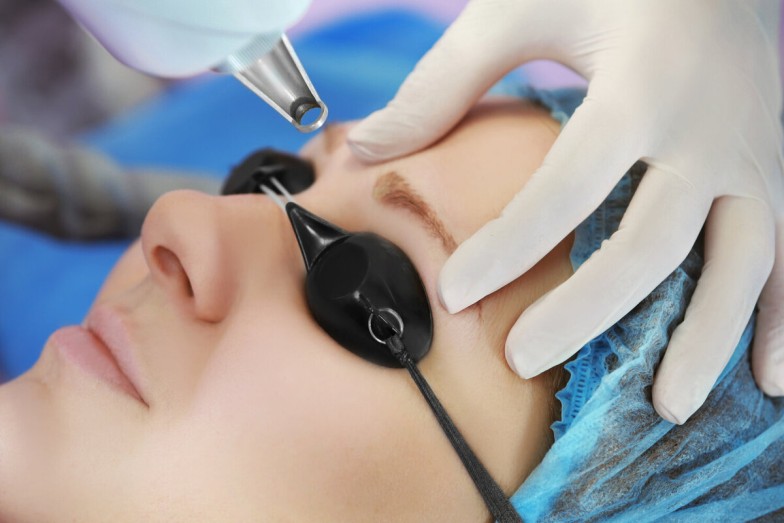 Eyebrow Laser Hair Removal