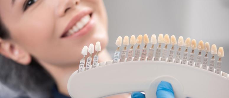 Ceramic Crowns Ceramic Crowns
