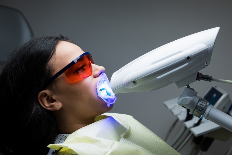 Laser Teeth Cleaning