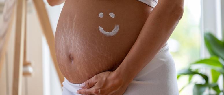 stretch marks during pregnancy stretch marks during pregnancy