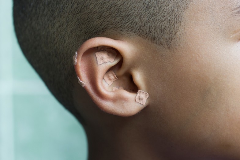 ear